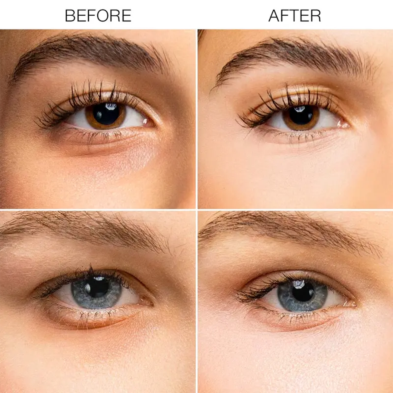 LOVILDS Under Eye Brightener with Caffeine and Peptides visibly reduces dark circles and brightens