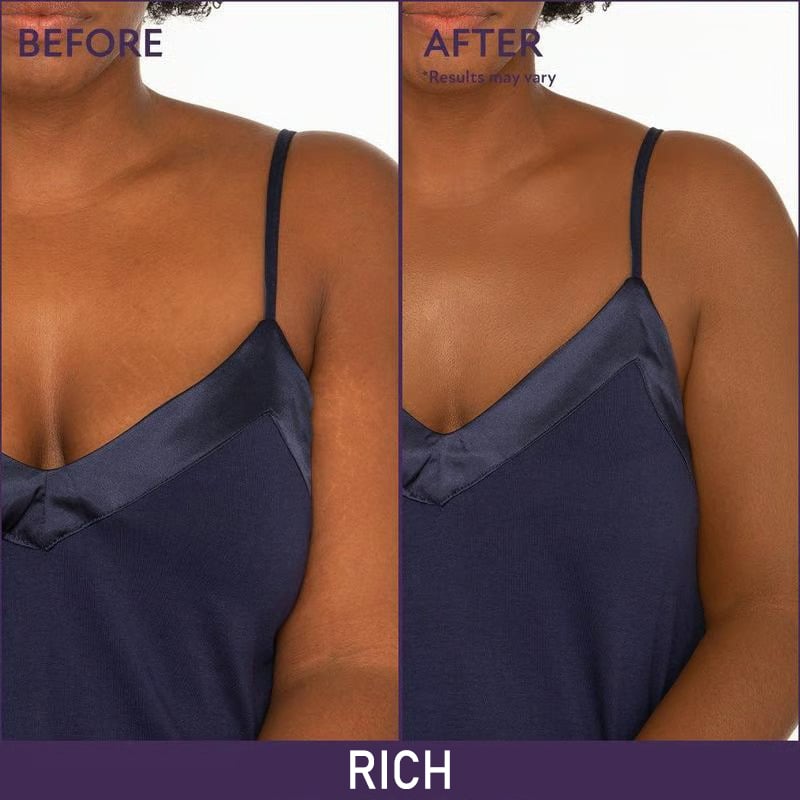 Final 3 Hours: 60%OFF-Soft Matte Cream Concealer with Brush FREE !š