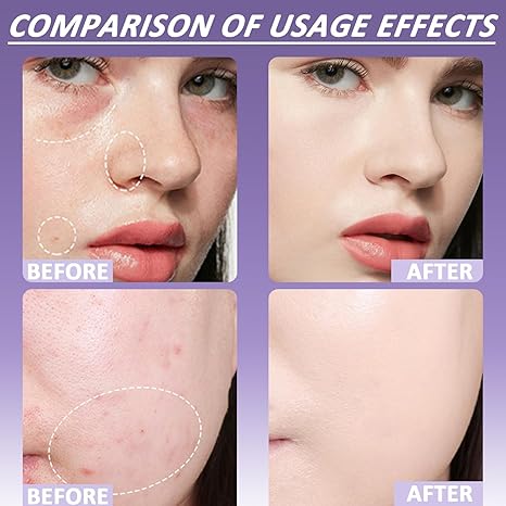 Final 3 Hours: 60%OFF-Soft Matte Cream Concealer with Brush FREE !š