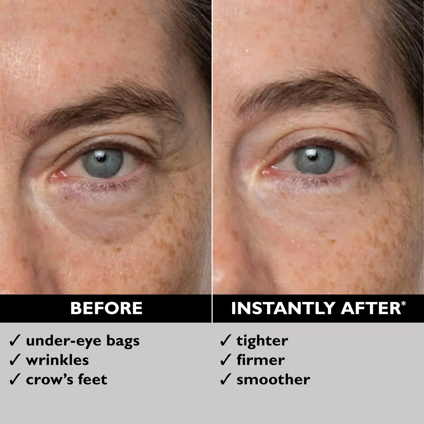 Divifit Eye Bag Instant Eraser, Tightens, Firms, & Blurs Wrinkles