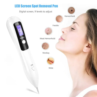 Slimoly™ LCD Beauty Pen – Ultrasonic Facial Massager for Fine Lines & Circulation